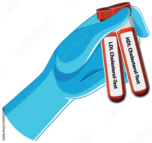 Cholesterol Blood Test Illustration
