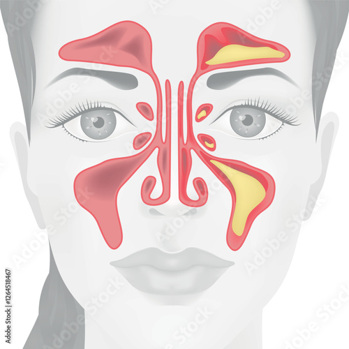 Medical poster, background, with a girl's face and a sinus. Vector