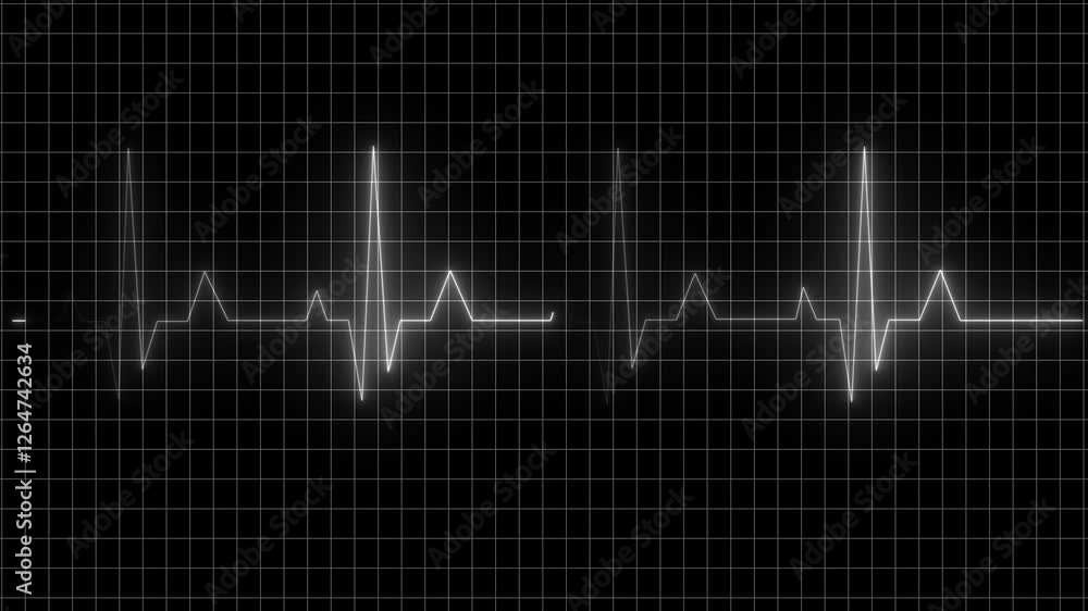 heart beat cardiogram . Medical Heartbeat Monitor – White Pulse Animation, Seamless Loop. heart beat cardiogram . Medical Heartbeat Monitor – White Pulse Animation, Seamless Loop.
