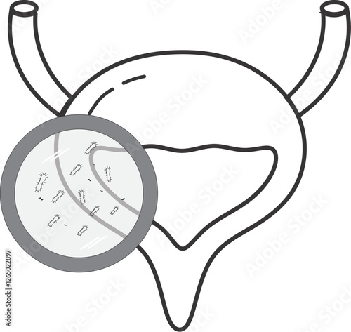Urinary tract infection(UTI) vector. Illustration of infect the urinary tract.