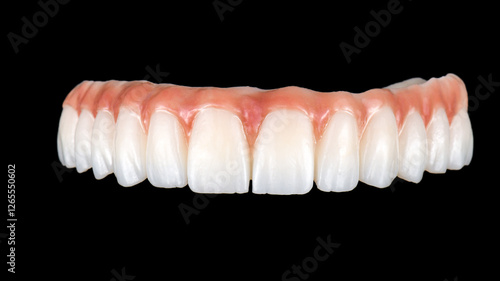 Canvas Print zirconium bridge on implants
