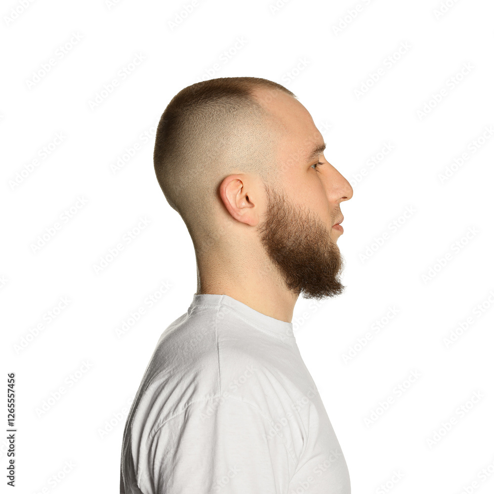Baldness problem. Man with receding hairline on white background Baldness problem. Man with receding hairline on white background