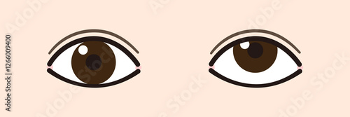 上斜視のイラスト
