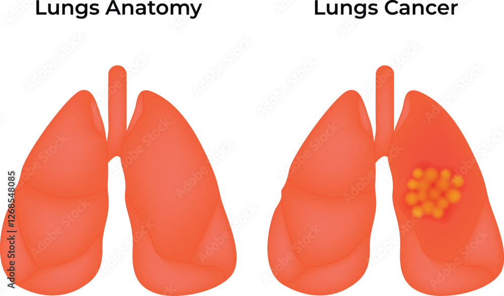 Fototapeta premium Healthy Lungs and Cancer Lungs Anatomy Science Design Vector Illustration Diagram