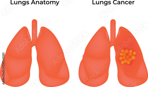 Healthy Lungs and Cancer Lungs Anatomy Science Design Vector Illustration Diagram