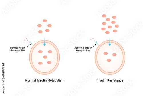 Insulin Resistance Science Design. Vector Illustration.