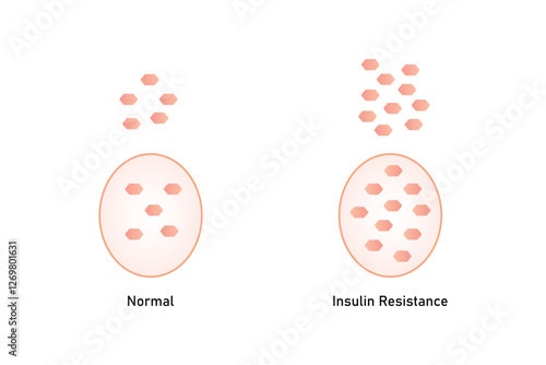 Insulin Resistance Science Design. Vector Illustration.