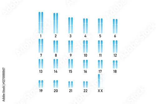 Turner Syndrome Science Design. Vector Illustration.