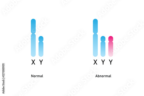 XYY Syndrome Science Design. Vector Illustration.
