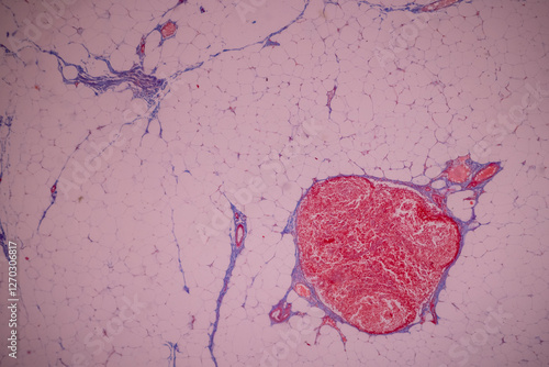 Showing Light micrograph of the Adrenal gland, Spleen human and Other human tissues under the microscope for education in the laboratory. photo