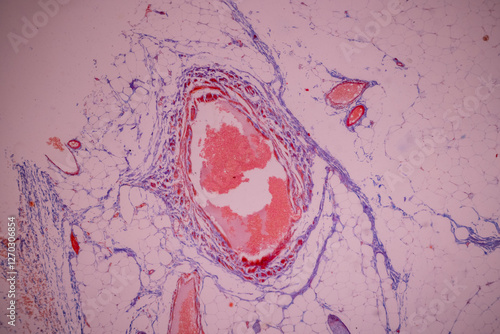 Showing Light micrograph of the Adrenal gland, Spleen human and Other human tissues under the microscope for education in the laboratory. photo