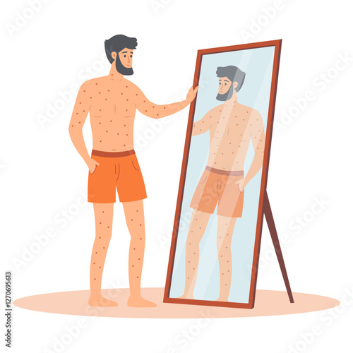 Sad man standing in front of a mirror with red spots on his body. Man character suffers from rash. Vector cartoon illustration.