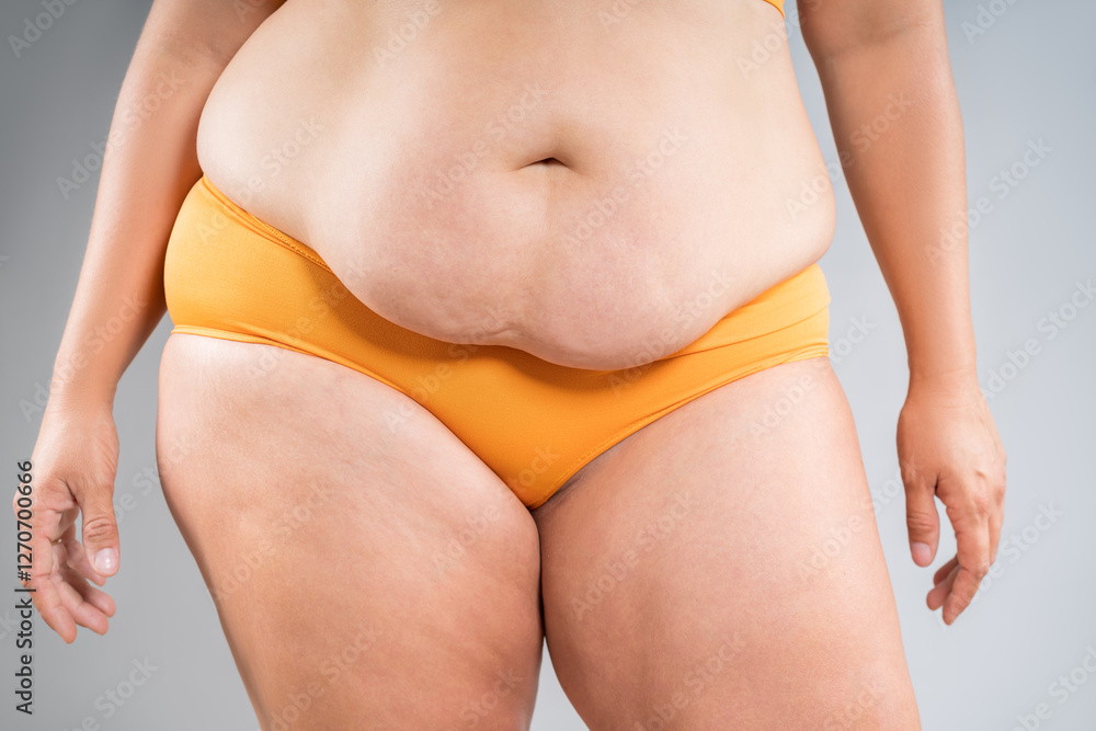 Φωτογραφία Tummy tuck, flabby skin on a fat belly, abdomen with obesity and cellulite, sagg