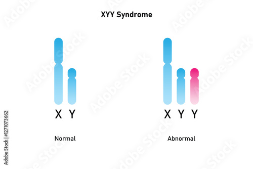 XYY Syndrome Science Design. Vector Illustration.