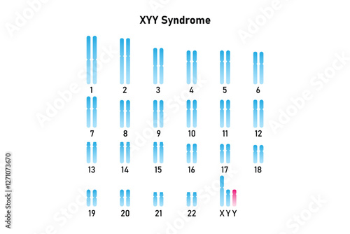 XYY Syndrome Science Design. Vector Illustration.