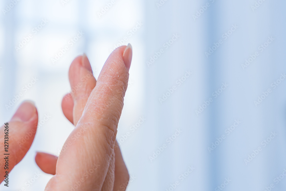 Naklejka premium Close-up of a womans dry hands with peeling skin in winter, skincare and hydration concept.