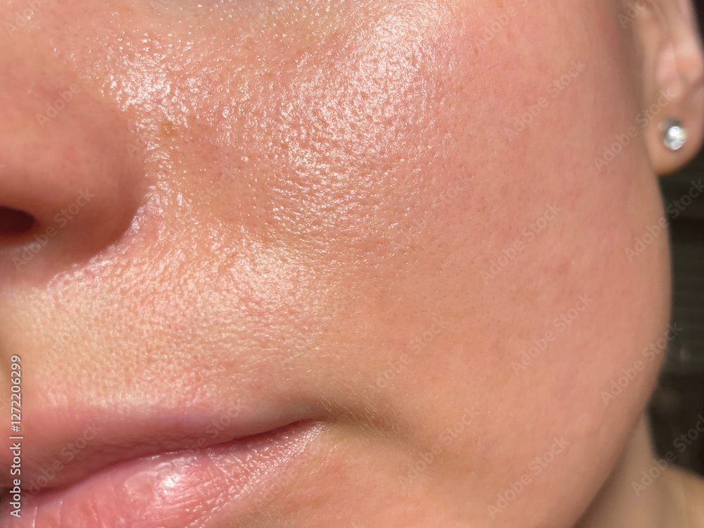 Macro photo of big pore on oily facial skin type. Skin with enlarged pores. Care for problem skin. Sun, natural light Macro photo of big pore on oily facial skin type. Skin with enlarged pores. Care for problem skin. Sun, natural light