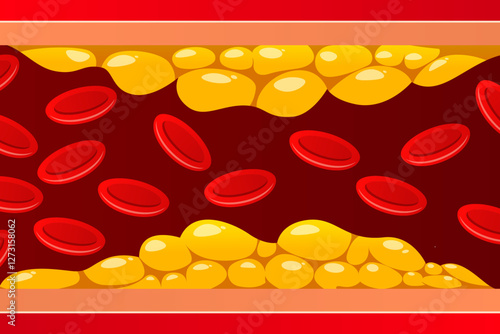 Illustration cholesterol blood vessels bacground.
