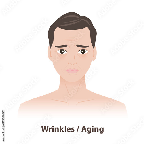 The man with wrinkles and fine lines on face vector illustration isolated on white background. Skin problems in men include aging, particularly around the eyes and forehead. Men skin care concept.