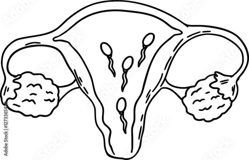 sketch cervix photo