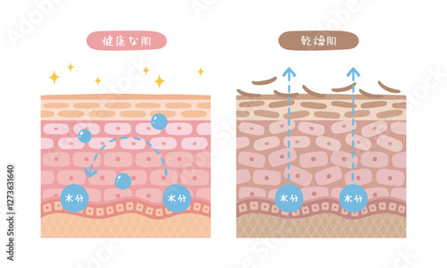 健康な肌と乾燥肌の断面図のイラスト