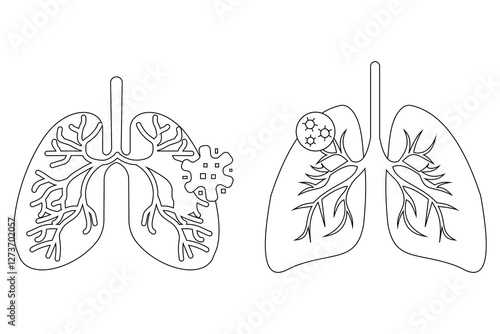 Lung disease icon set. Lung infection solid icon. Lung disease such as cough, bronchitis, spirometry,  bronchial asthma. Health problems concept vector illustration.