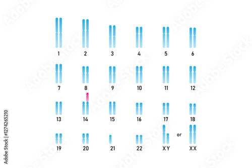 Translocation Down Syndrome Science Design. Vector Illustration.