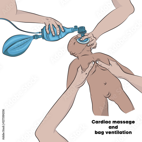Vector Cardiac massage in babies.
