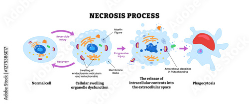 Necrosis process diagram infographic, labeled scheme with normal cell, cellular swelling organelle dysfunction, release intracellular, phagocytosis, recovery, death cell in body tissues. biology