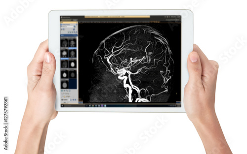 Magnetic Resonance Angiography (MRA) of the Brain photo