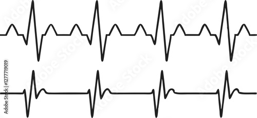 Heartbeat line set. EKG. Vector