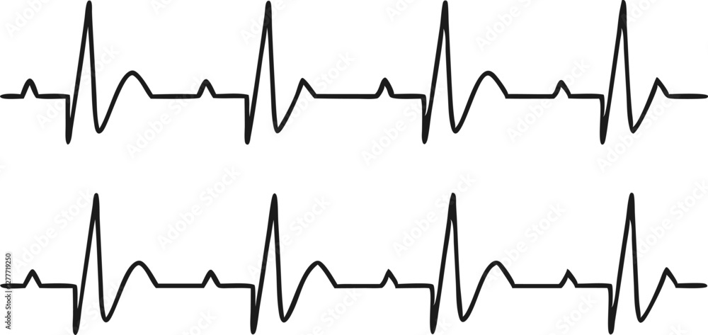 Fototapeta premium Heartbeat line set. EKG. Vector