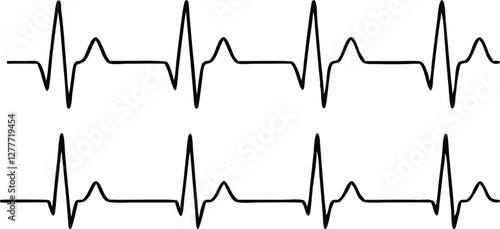 Heartbeat line set. EKG. Vector