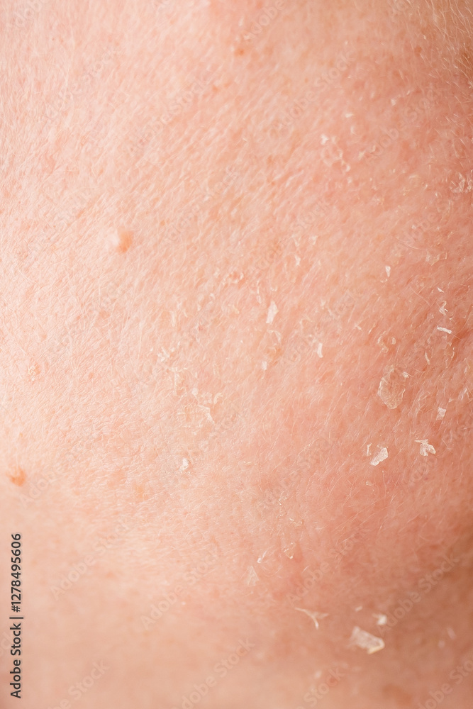 Skin texture showcasing dry patches and exfoliation process on a close-up view of the arm during daytime Skin texture showcasing dry patches and exfoliation process on a close-up view of the arm during daytime
