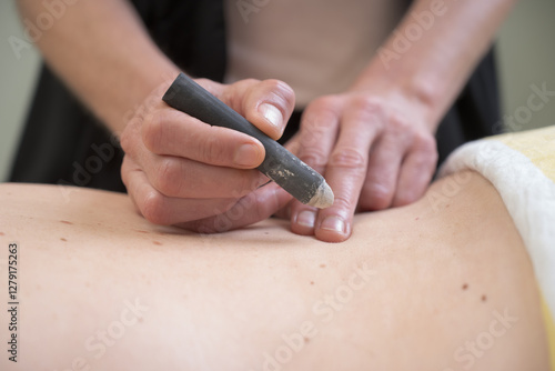 Canvastavla Moxibustion Therapy in Traditional Chinese Medicine - Close-up of Practitioner A