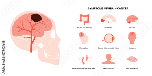 Primary brain tumors