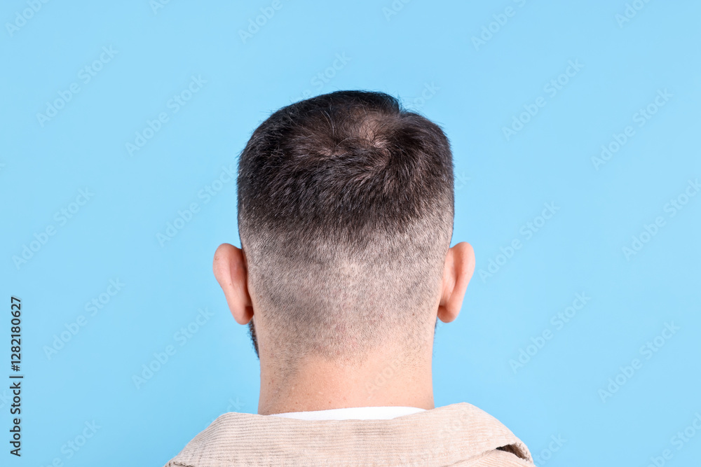 Obraz premium Baldness problem. Man with bald spot on light blue background, back view