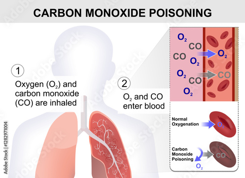 Carbon Monoxide Poisoning Illustration CO in Blood