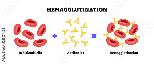 Hemagglutination or haemagglutination. agglutination form, antibodies bind to antigens and clumping of erythrocytes or red blood cell, Blood type determination, assay, biology education.