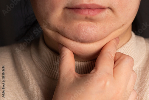 Closeup of woman second chin. Overweight problem. Facial line correction concept.