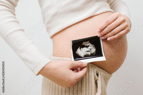 Happy expectant mom shows fetus ultrasound image after sonogram. Pregnant holds sonogram picture of unborn baby inside her big belly. photo