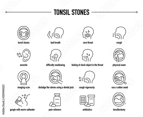 Tonsil Stones symptoms, diagnostic and treatment vector icon set. Line editable medical icons