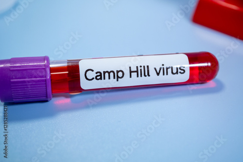 A new pathogen, called Camp Hill virus, was recently discovered in Alabama, drawing attention to a group of viruses known as henipaviruses photo