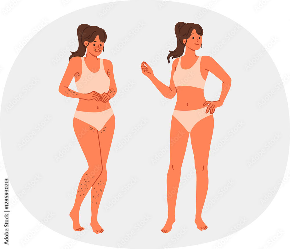 Girl uses depilation and laser hair removal, demonstrating result of visit to cosmetologist. Young woman recommends depilation of legs and face or bikini area using sugaring or hot wax