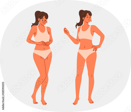 Obraz na płótnie Girl uses depilation and laser hair removal, demonstrating result of visit to cosmetologist. Young woman recommends depilation of legs and face or bikini area using sugaring or hot wax w salonie