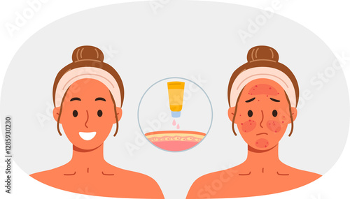 Obraz na płótnie Sunscreen that protects skin from burns and solar radiation, next to girls demonstrating results before and after. Sunscreen for solarium visitors or tourists vacationing in tropical countries w salonie