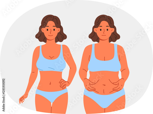 Obraz na płótnie Thinner woman compares result before and after using new diet or joining fitness club with personal trainer. Thinner girl in swimsuit shows off excellent effect of liposuction done by surgeon w salonie
