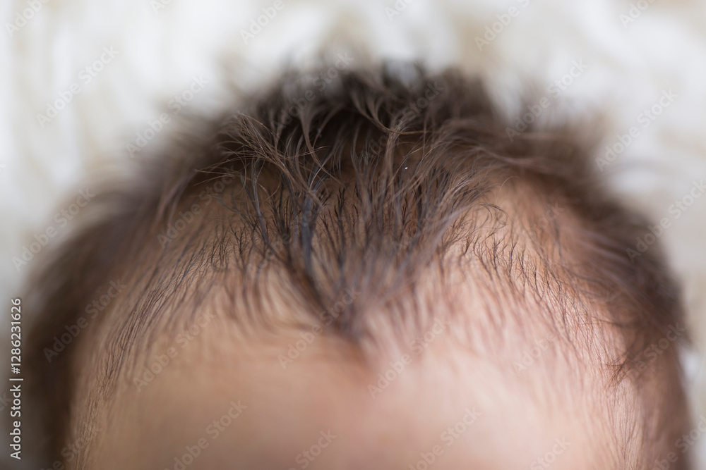 Top of human newborn baby head forehead Top of human newborn baby head forehead