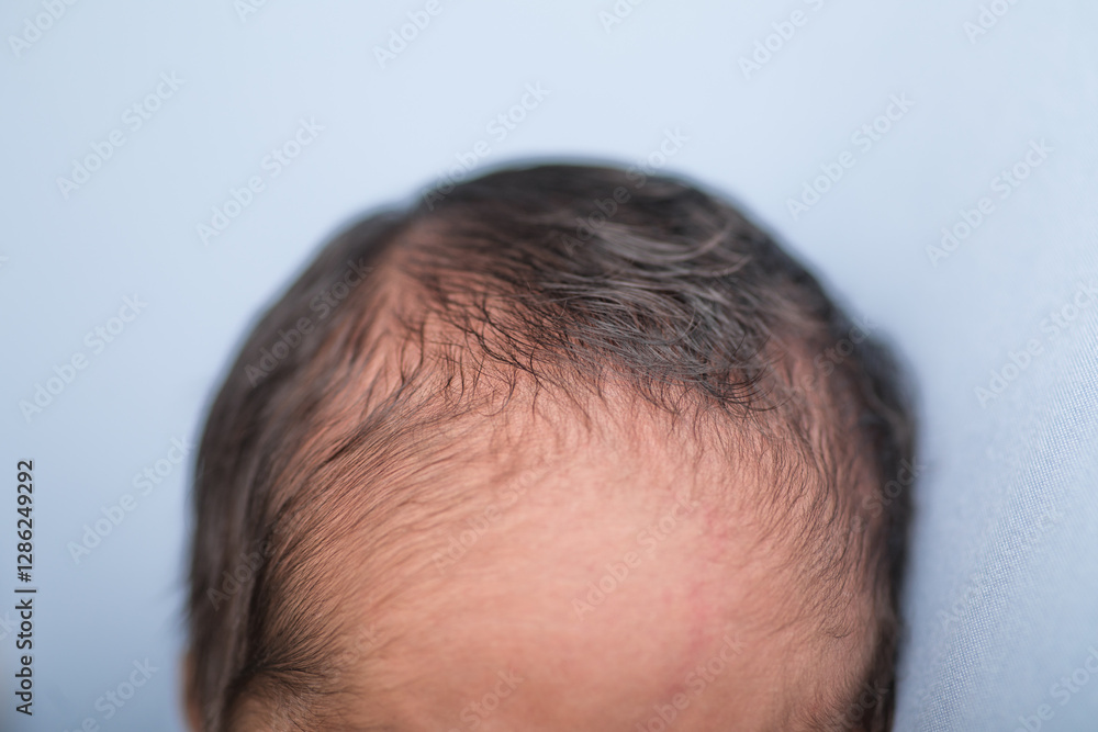 Obraz premium Top of newborn baby head forehead hair hairline sweet and cute