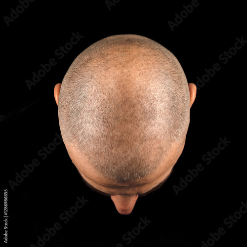 Close-up top view of a bald man's head with short stubble, isolated on a black background.